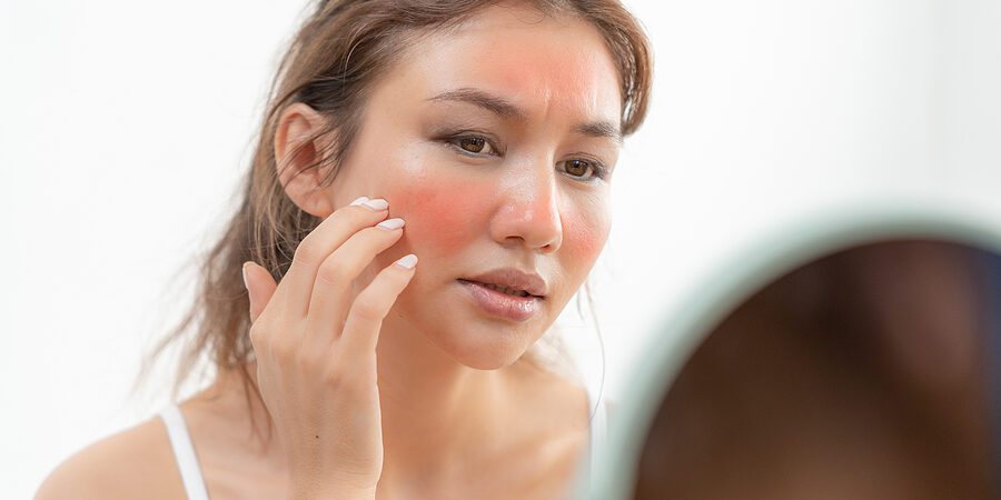 Young Woman Are Worried About Faces Dermatology And Allergic To Girl looking in mirror at her sun damaged skin